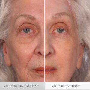 Serious Skincare INSTA-TOX Instant Wrinkle Smoothing Skin Serum TRIO – Temporarily Tightens Face – Instantly Reduce Appearance of Lines, Wrinkles & Large Pores – For Women & Men – .75 Fl. Oz. (3Pack)