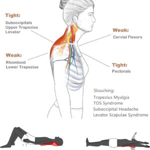 Trapezius Trigger Point Massager, Myofasical Release Neck and Shoulder Pain, Suboccipital Release Tool, Posture Corrector, Relieve Upper Back Pain &Tension Headache
