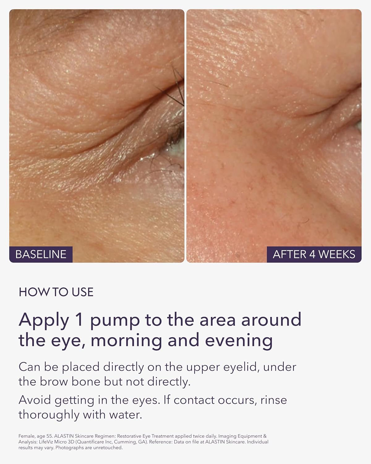 ALASTIN Skincare Restorative Eye Treatment (0.5 oz) | Anti-Aging Eye Cream | Helps Reduce Dark Circles & Puffiness | Firming & Hydrating - Image 5