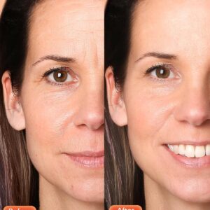 NEWKEY Red Light Therapy Mask for Face,7 Colors LED Face Mask Light Therapy, At-Home Photon Skin Care Beauty Mask for Anti Wrinkles Acne Reduction